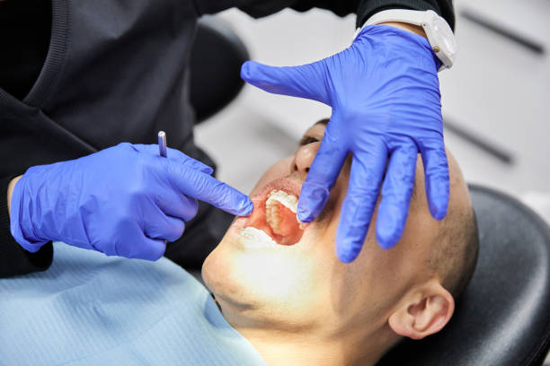 Best Dentist for Tooth Abscess  in Delmar, MD